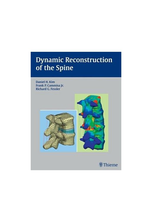 Dynamic Reconstruction of the Spine