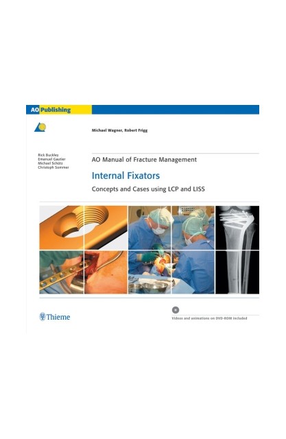 AO Manual of Fracture...