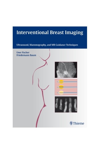 Interventional Breast Imaging