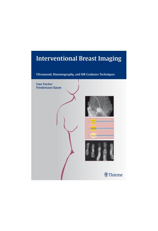 Interventional Breast Imaging