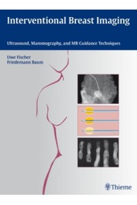 Interventional Breast Imaging