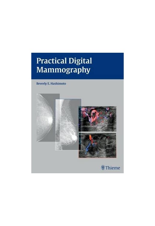 Practical Digital Mammography