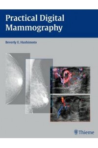 Practical Digital Mammography