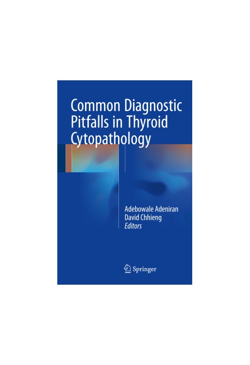 Common Diagnostic Pitfalls in Thyroid Cytopathology 2016