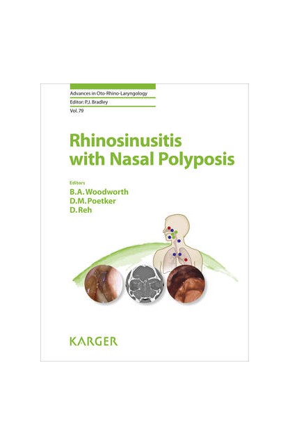 Rhinosinusitis with Nasal...