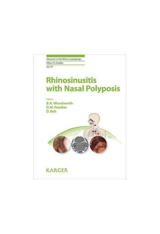 Rhinosinusitis with Nasal Polyposis