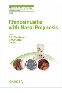 Rhinosinusitis with Nasal Polyposis