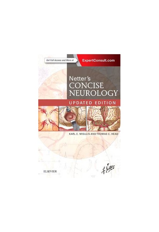 Netter's Concise Neurology
