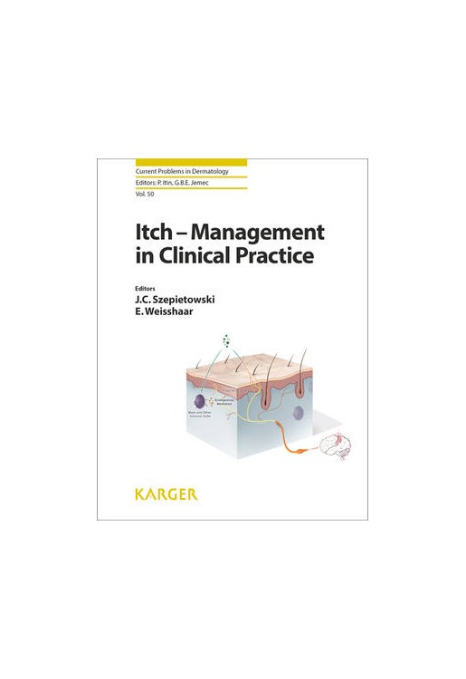 Itch - Management in Clinical Practice