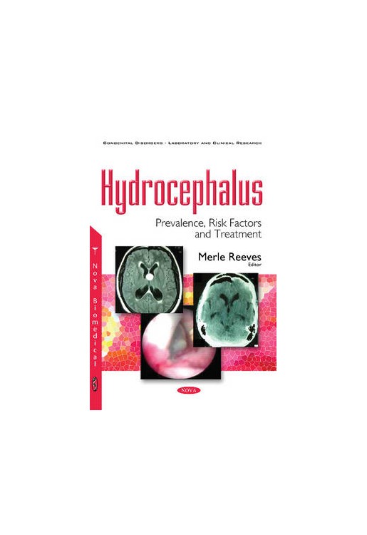 Hydrocephalus