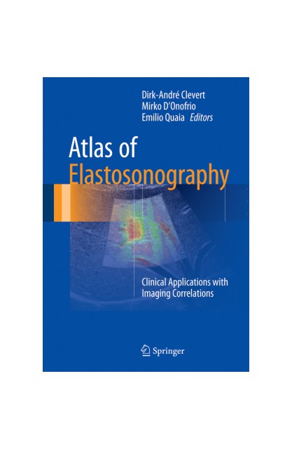 Atlas of Elastosonography 2017