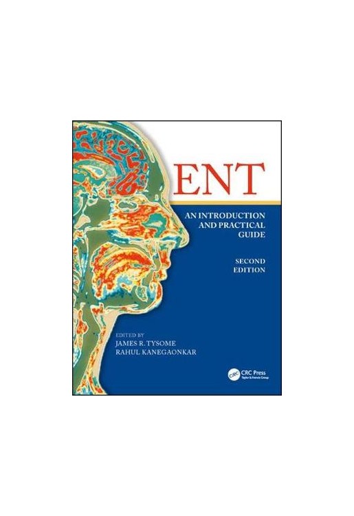 ENT: An Introduction and Practical Guide, Second Edition