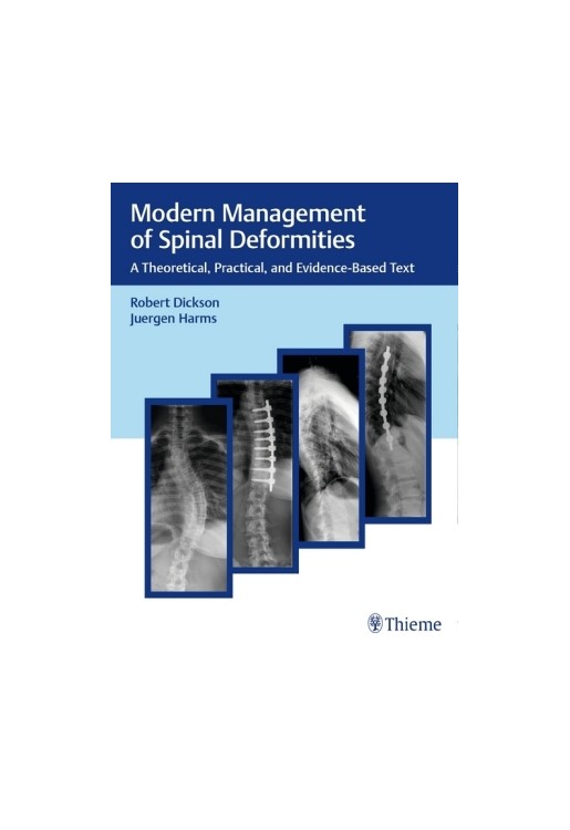 Modern Management of Spinal Deformities