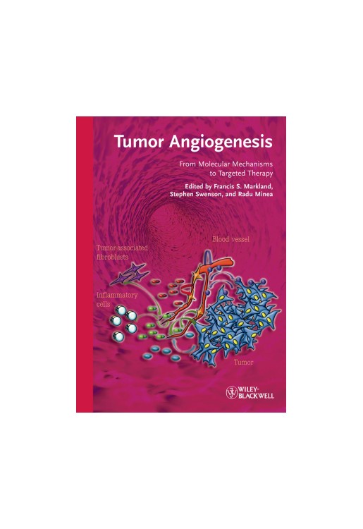 Tumor Angiogenesis From Molecular Mechanisms to Targeted The