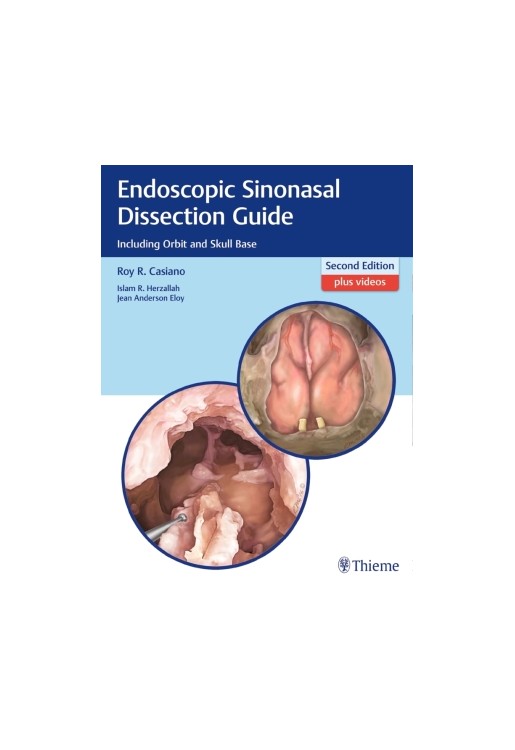 Endoscopic Sinonasal Dissection Guide