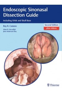 Endoscopic Sinonasal Dissection Guide