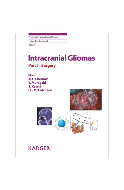 Intracranial Gliomas Part I...