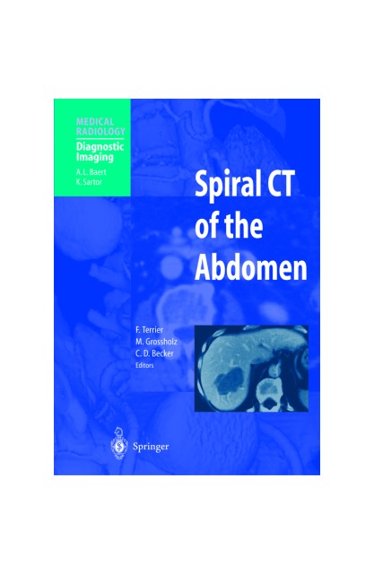 Spiral CT of Abdomen