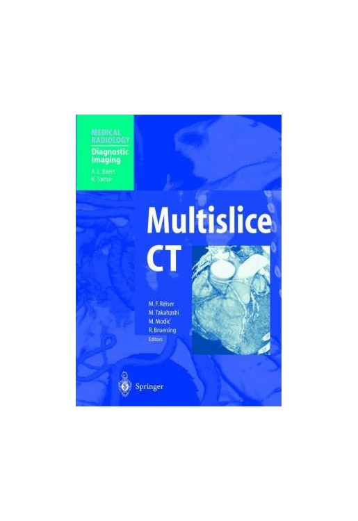 Multislice CT