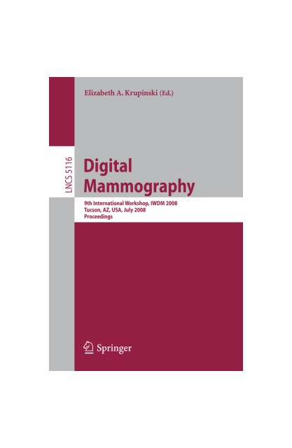 Digital Mammography