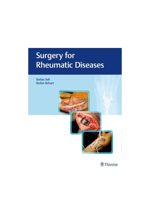 Surgery for Rheumatic Diseases