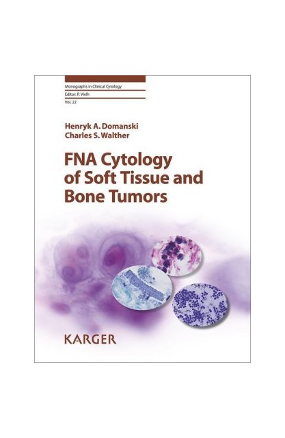 FNA Cytology of Soft Tissue...