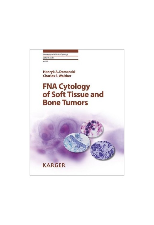 FNA Cytology of Soft Tissue and Bone Tumors