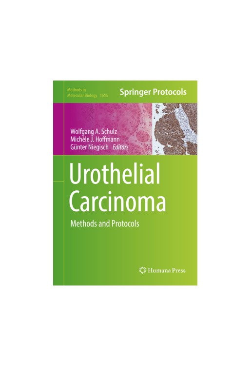 Urothelial Carcinoma