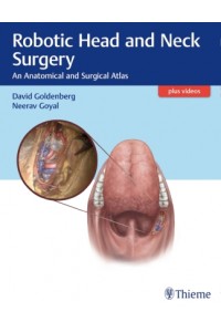 Robotic Head and Neck Surgery