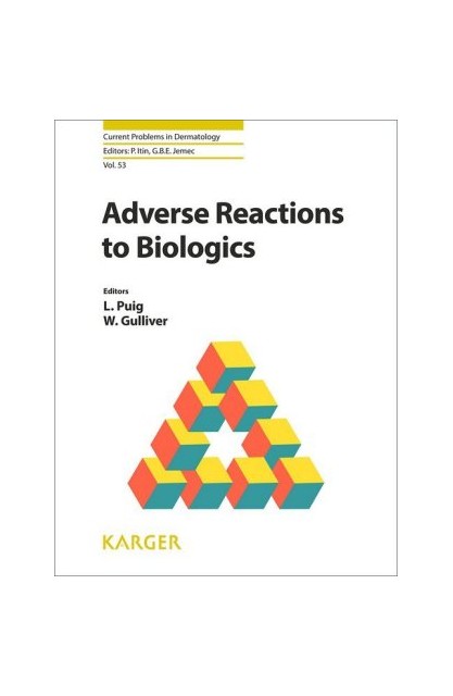 Adverse Reactions to Biologics