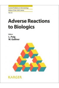 Adverse Reactions to Biologics