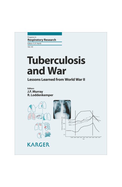 Tuberculosis and War