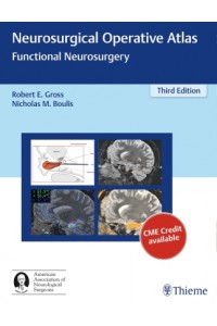 Neurosurgical Operative Atlas: Functional Neurosurgery