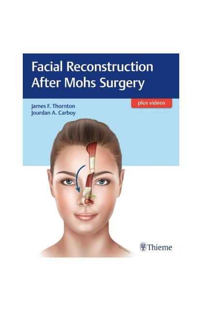 Facial Reconstruction After...