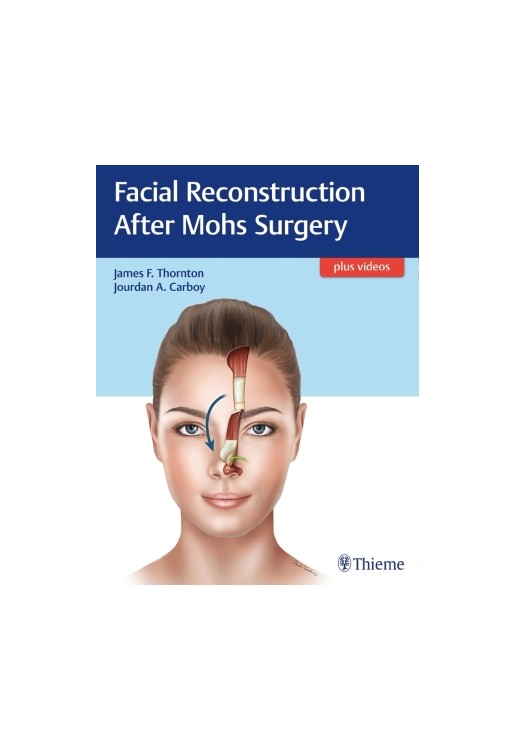 Facial Reconstruction After Mohs Surgery