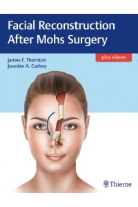 Facial Reconstruction After Mohs Surgery