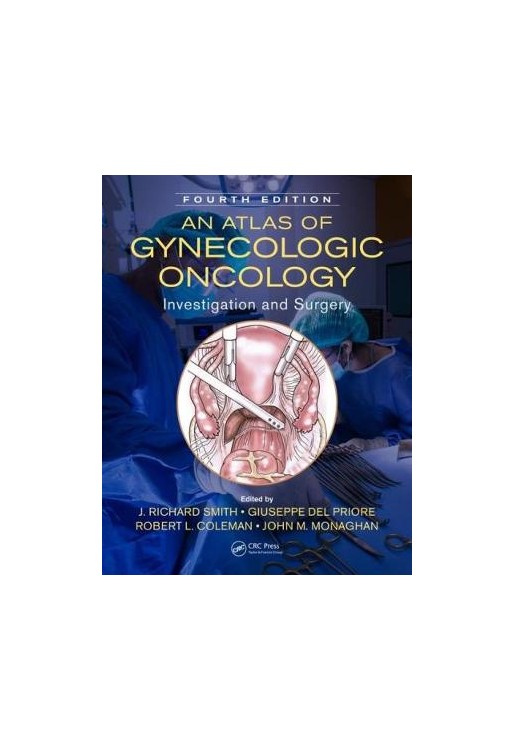 An Atlas of Gynecologic Oncology