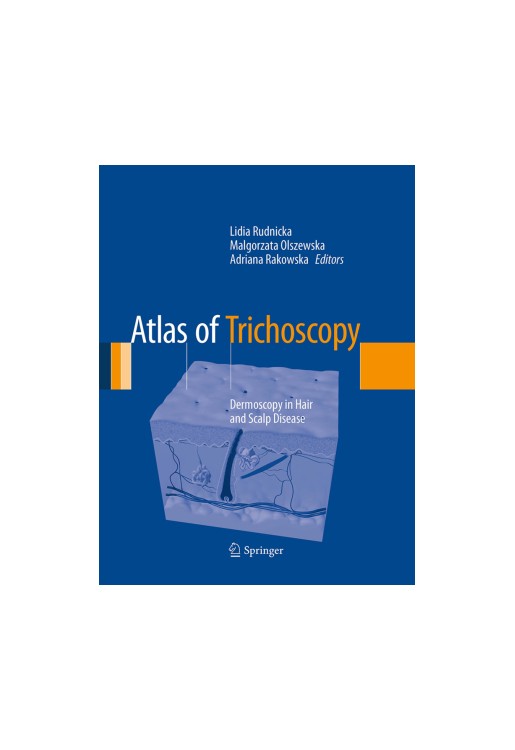 Atlas of Trichoscopy