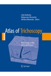 Atlas of Trichoscopy