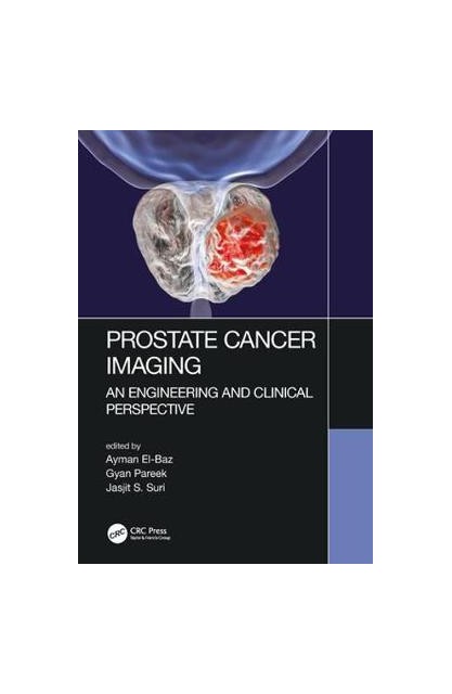 Prostate Cancer Imaging