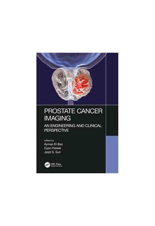 Prostate Cancer Imaging