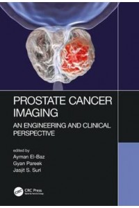 Prostate Cancer Imaging