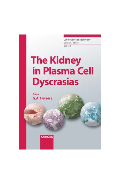 Kidney in Plasma Cell...