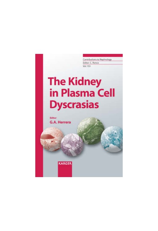 Kidney in Plasma Cell Dyscrasias