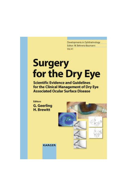 Surgery for the Dry Eye