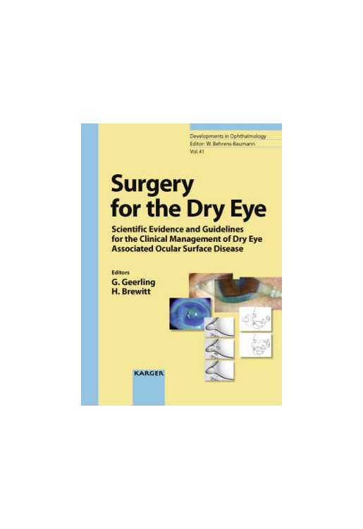 Surgery for the Dry Eye