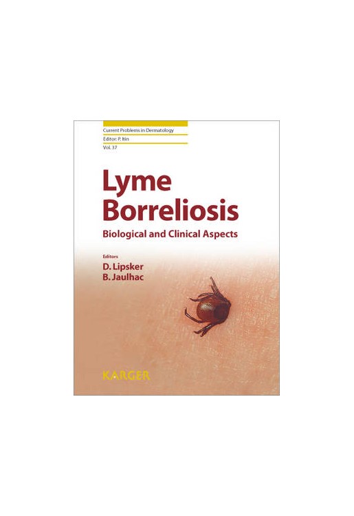 Lyme Borreliosis