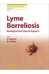 Lyme Borreliosis
