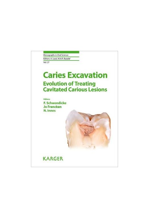 Caries Excavation: Evolution of Treating Cavitated Carious Lesions