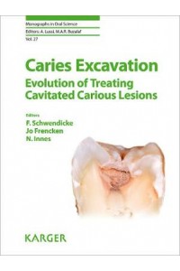 Caries Excavation: Evolution of Treating Cavitated Carious Lesions